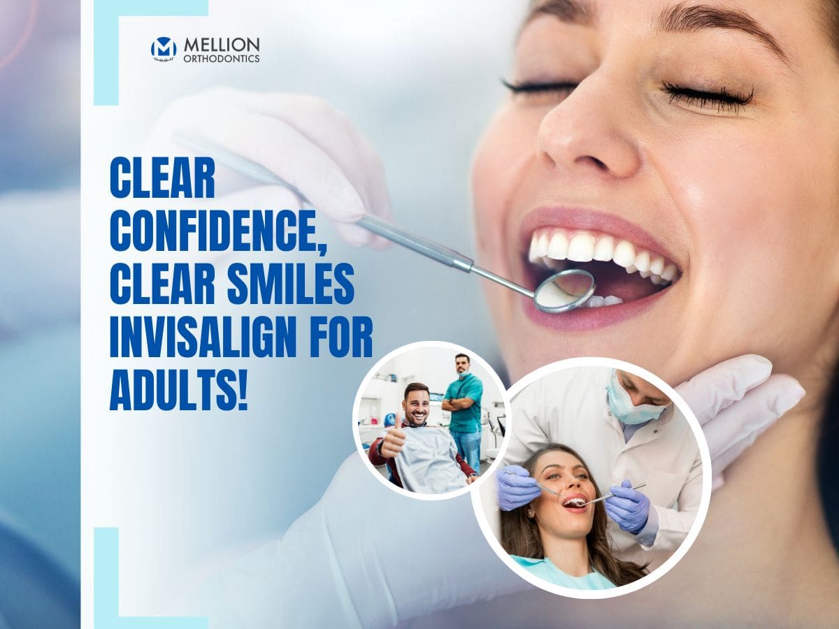 Invisalign Treatment for Adults