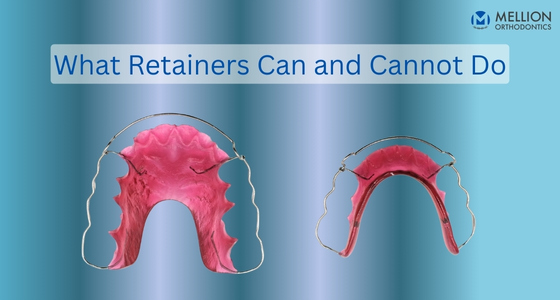 What Retainers Can and Cannot Do