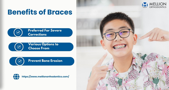 Benefits of Braces