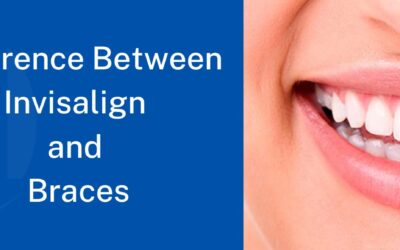 Difference Between Invisalign and Braces : Which Is Better?
