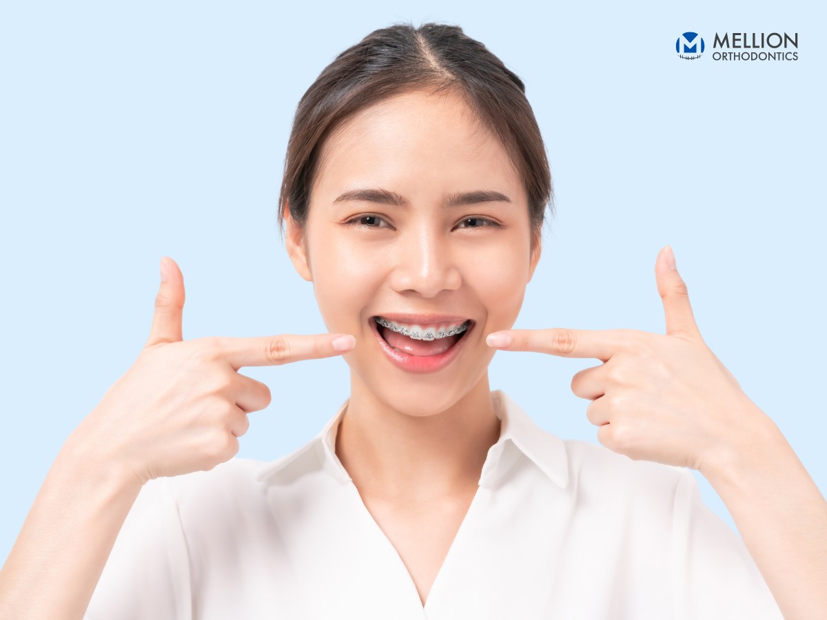 why-choose-mellion-orthodontics-for Teens Braces