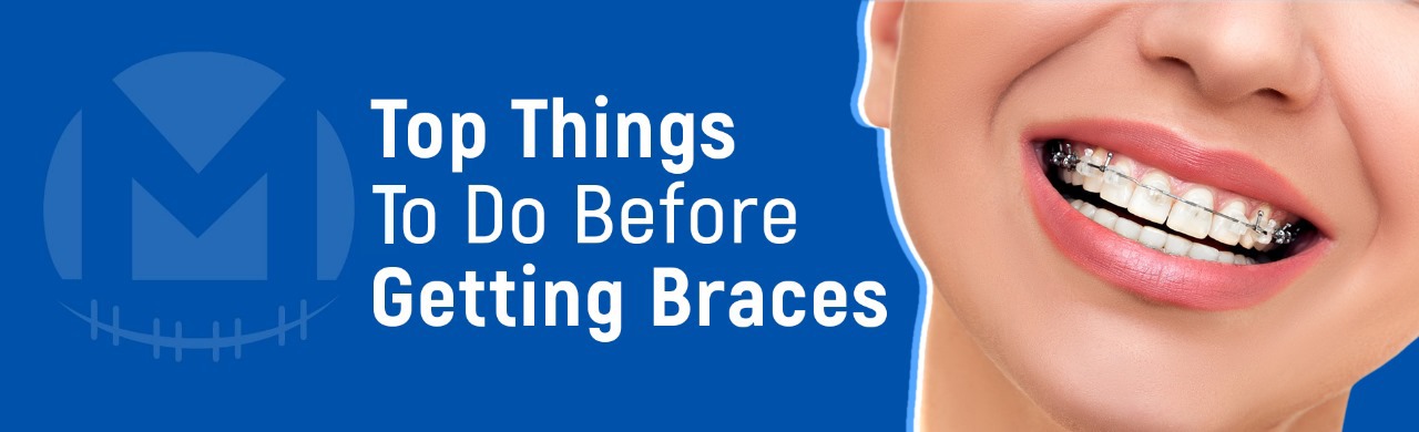 Top Things to do before getting braces Top Things to Do Before Getting Braces