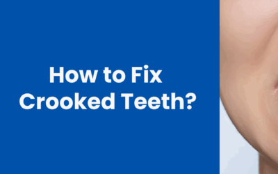 How to Fix Crooked Teeth: Causes and Treatment Options