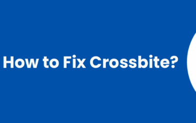 How to Fix Crossbite: Treatment Options That Really Work