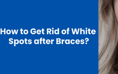 How to Get Rid of White Spots after Braces?