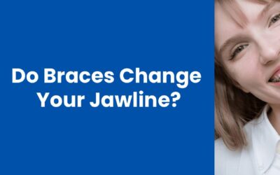 Do Braces Change Your Jawline and Face Shape? Myths vs. Facts