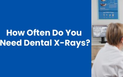 How Often Do You Need Dental X-Rays? A Clear Guide for Orthodontic Care