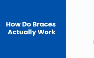 Behind the Smile: How Do Braces Actually Work