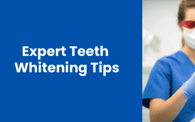 Expert Teeth Whitening Tips You Can Try at Home