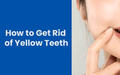 How to Get Rid of Yellow Teeth: 5 Effective Solutions